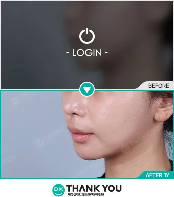 Before/After
