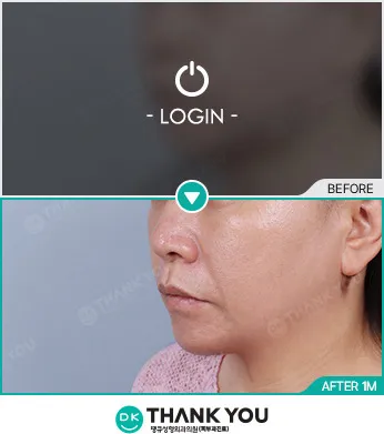 Before/After