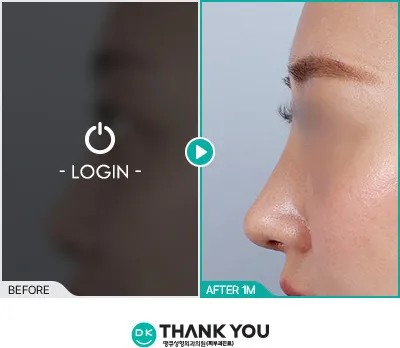 Before/After