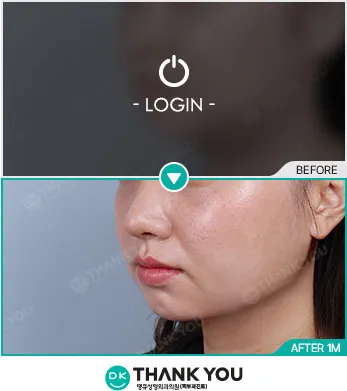 Before/After