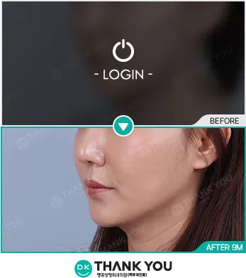 Before & After