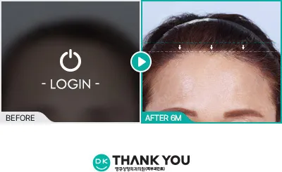 Before/After