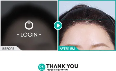 Before/After
