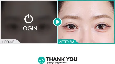Before/After