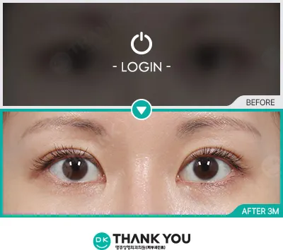 Before/After