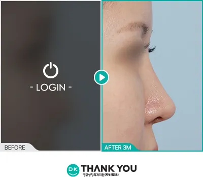 Before/After
