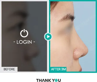 Before/After