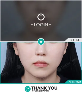 Before/After