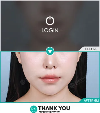 Before/After