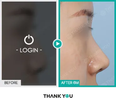 Before/After