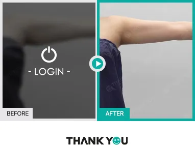 Before/After