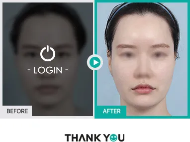Before/After