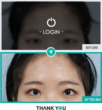 Before & After