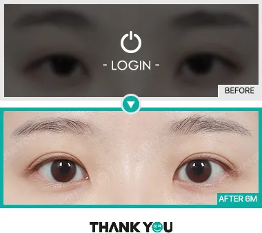 Before/After