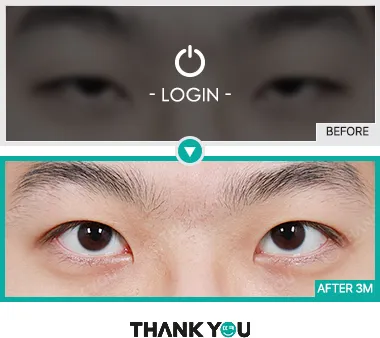 Before/After