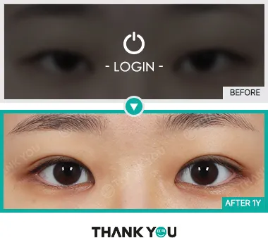 Before/After