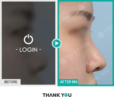 Before/After