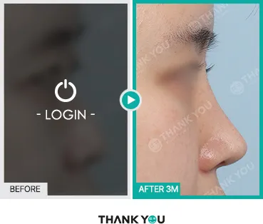 Before/After