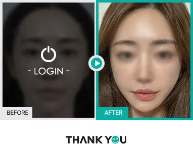 Before/After