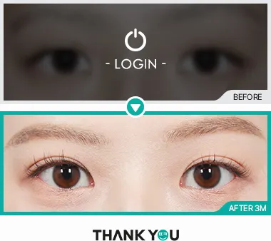 Before/After
