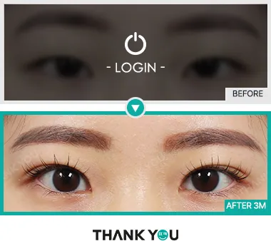 Before/After