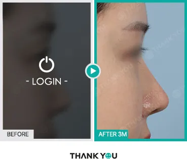 Before/After