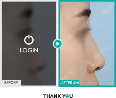 Before/After