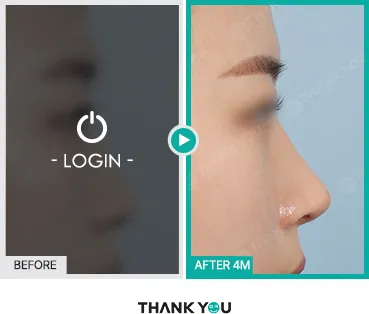 Before/After