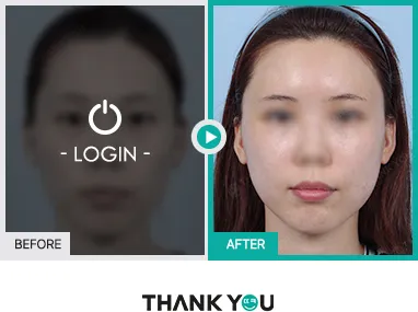 Before/After