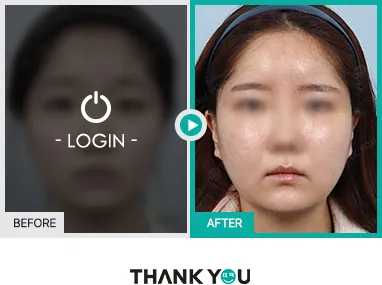 Before/After