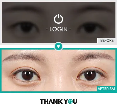 Before/After