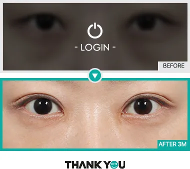 Before/After