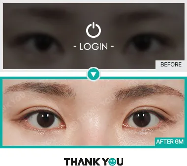 Before/After