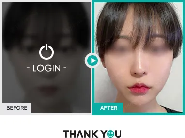 Before/After