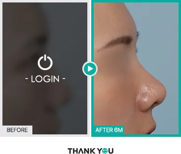 Before/After