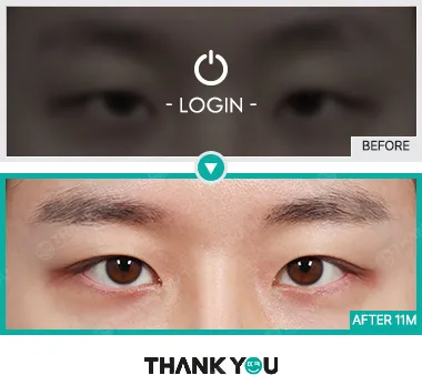 Before/After