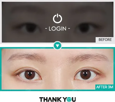 Before/After