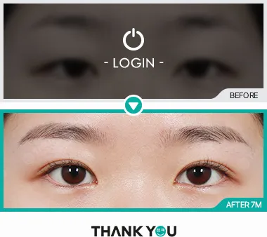 Before/After