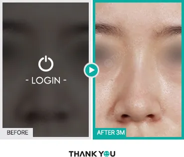 Before/After