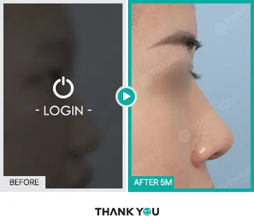 Before/After