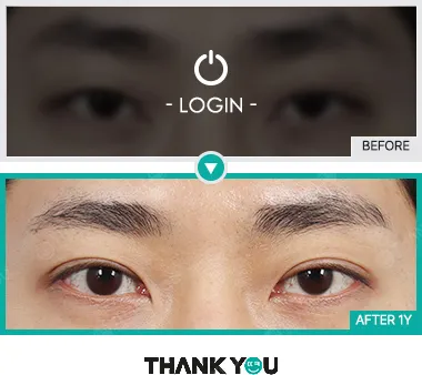 Before/After