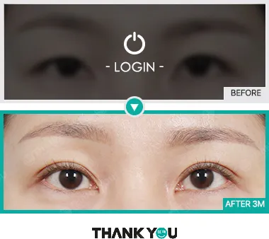 Before & After