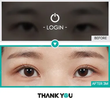 Before/After