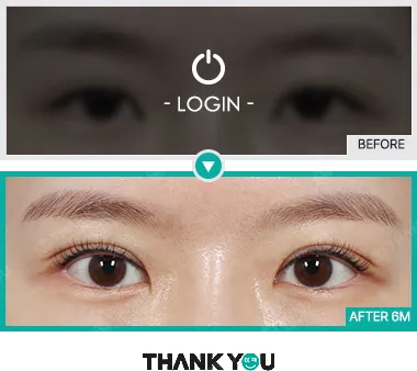 Before/After