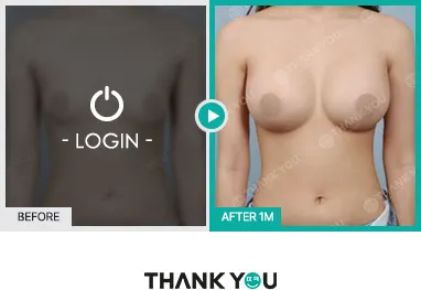 Before/After