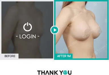 Before/After