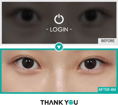 Before/After
