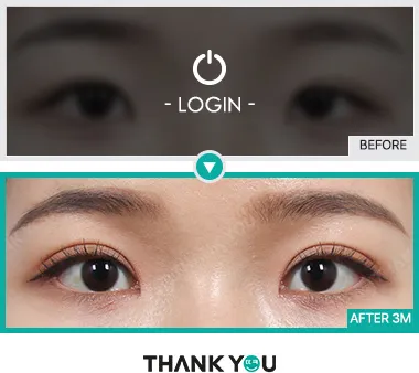 Before/After