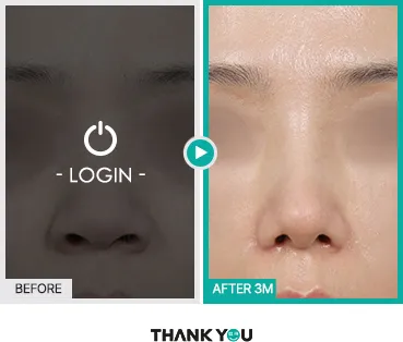 Before/After