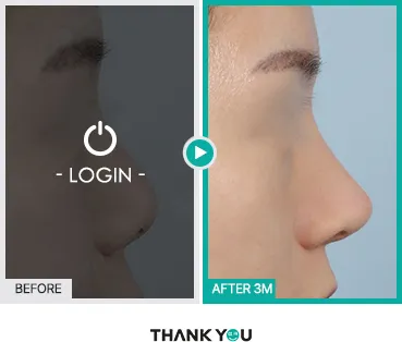 Before/After